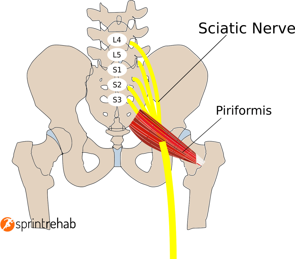 Drawing of the backside of a skeleton from L3 to upper femur. The nerves are shown exiting the right side of the lumbar spine and piercing the piriformis to exit and continue down the leg.